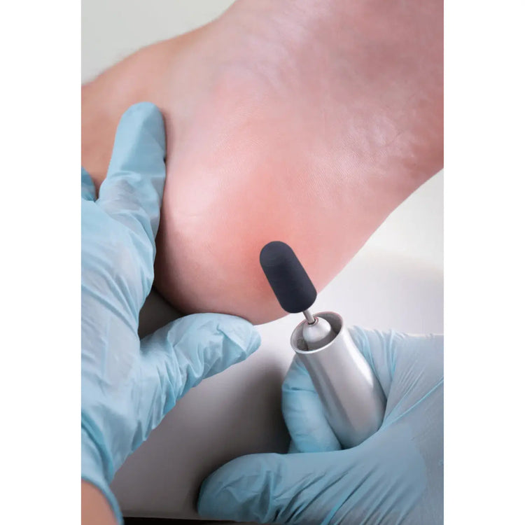 Capuchons abrasifs coniques x10 1501 - Diamant - Grain fin - Abrasion des cors, durillons et hyperkératoses - 5 mm Ruck