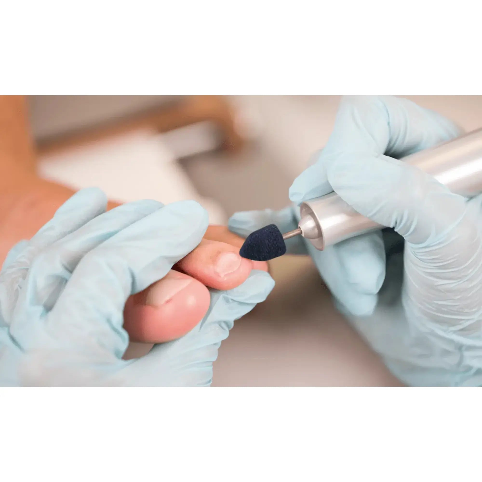 Capuchons abrasifs pointus x10 1004 - Diamant - Grain super gros - Abrasion des cors, durillons et hyperkératoses - 10 mm Ruck