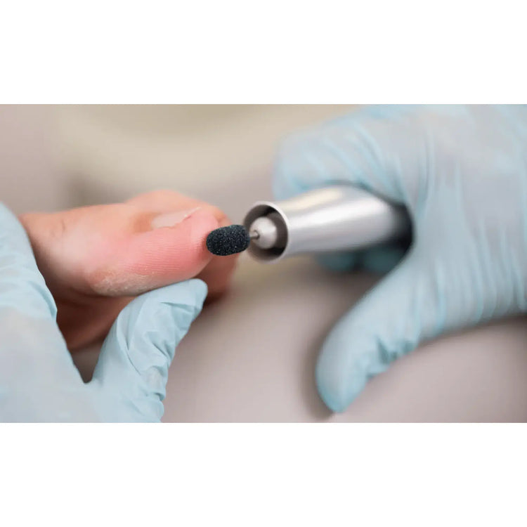 Capuchons abrasifs ronds x10 0503 - Diamant - Grain gros - Abrasion des cors, durillons et hyperkératoses - 13 mm Ruck