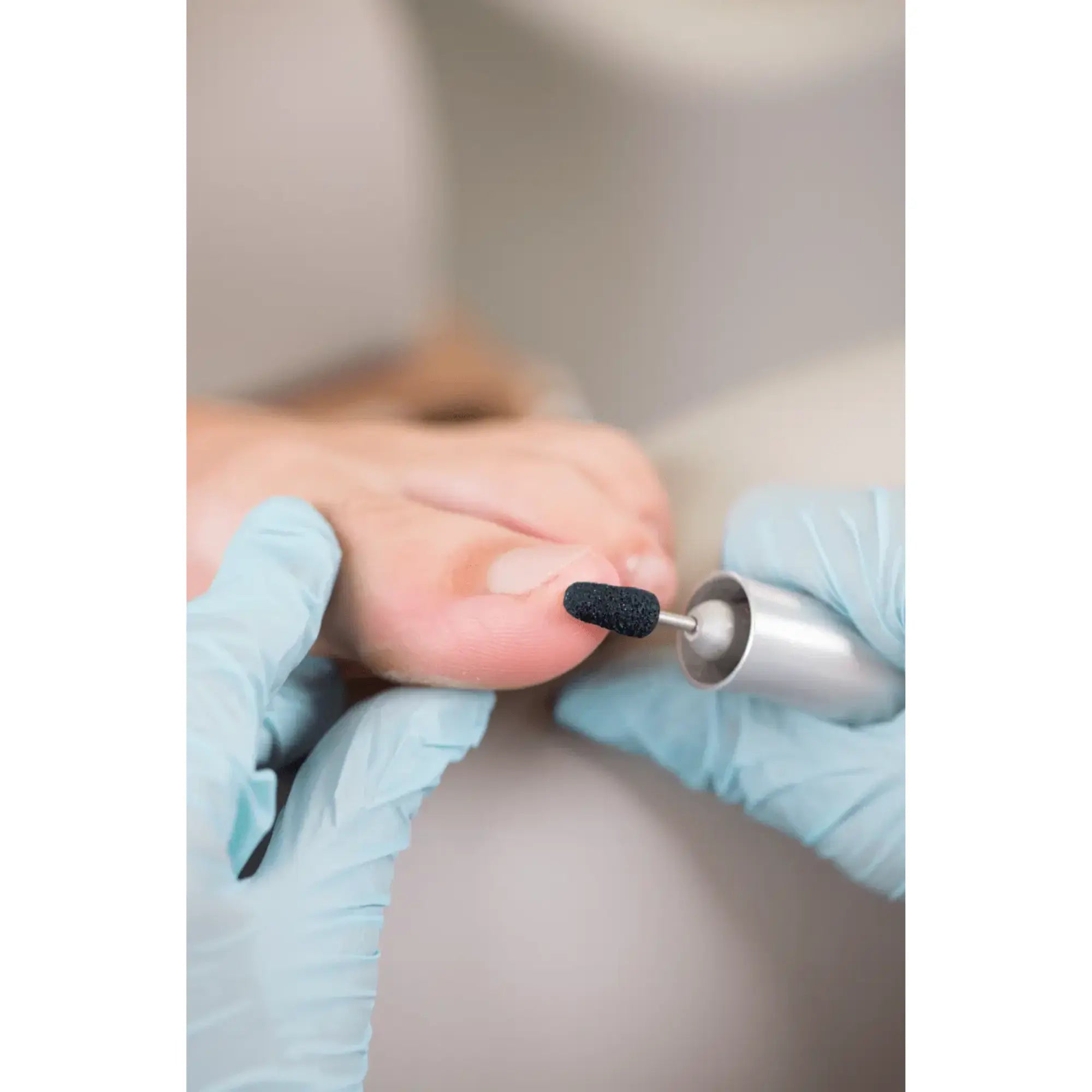 Capuchons abrasifs ronds x10 0504 - Diamant - Grain super gros - Abrasion des cors, durillons et hyperkératoses - 13 mm Ruck