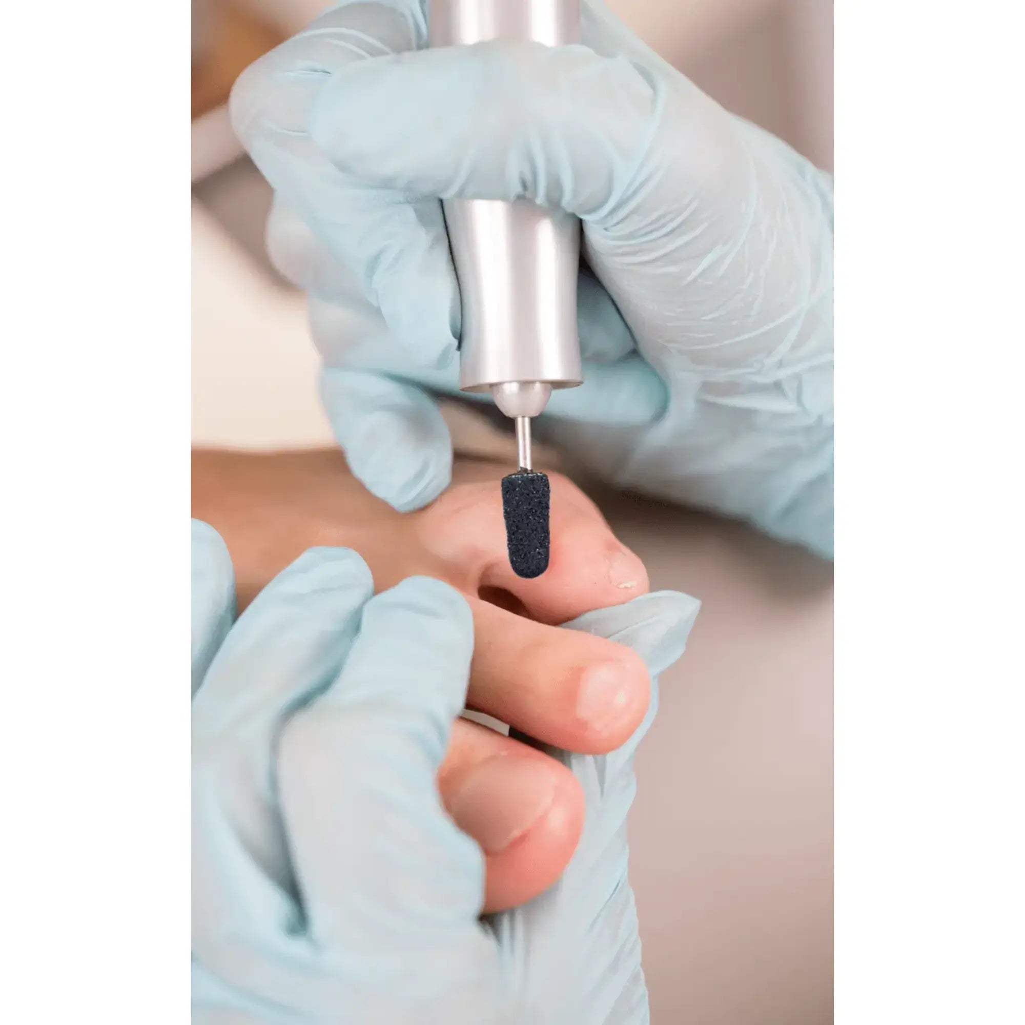 Capuchons abrasifs ronds x10 1402 - Diamant - Grain moyen - Abrasion des cors, durillons et hyperkératoses - 7 mm Ruck