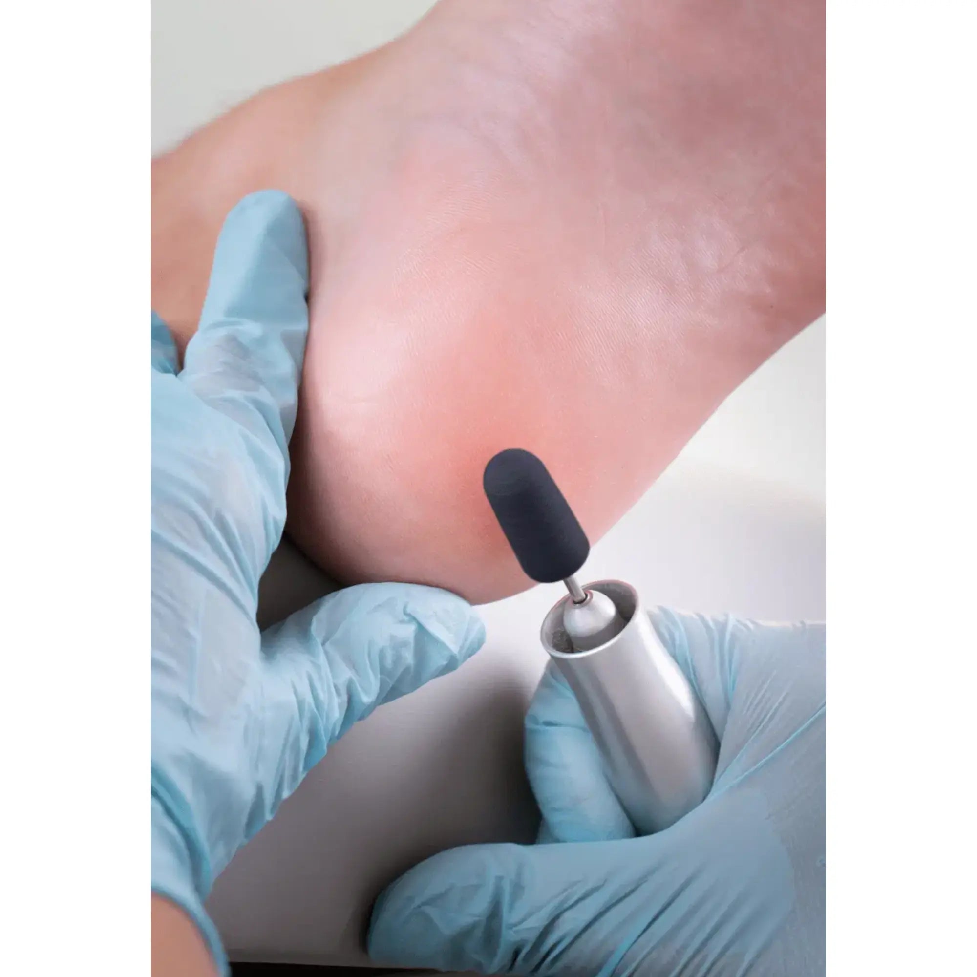 Capuchons abrasifs ronds x10 1404 - Diamant - Grain super gros - Abrasion des cors, durillons et hyperkératoses - 7 mm Ruck