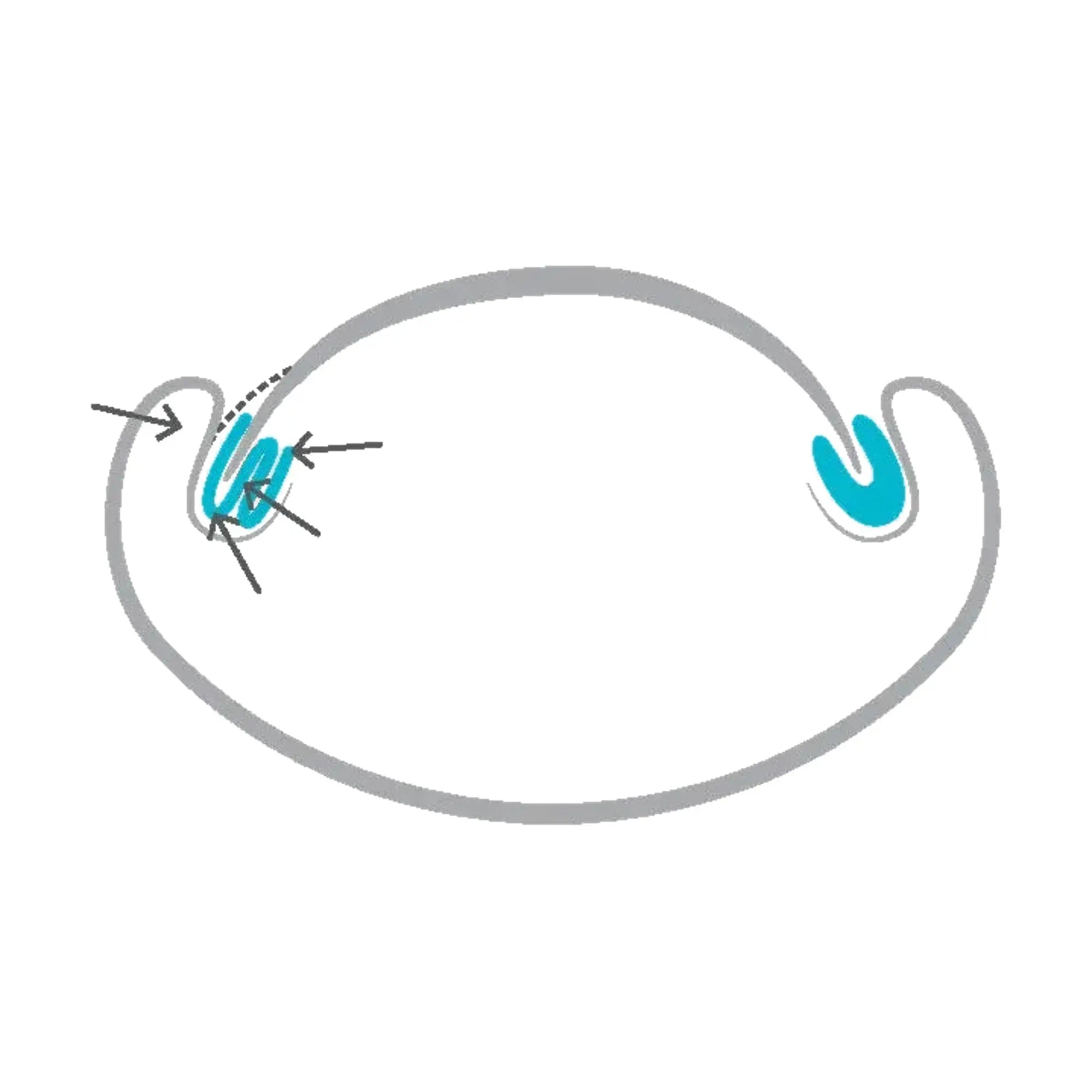 Copoline fine - 1,4 cm x 10 m - Ruck - My Podologie