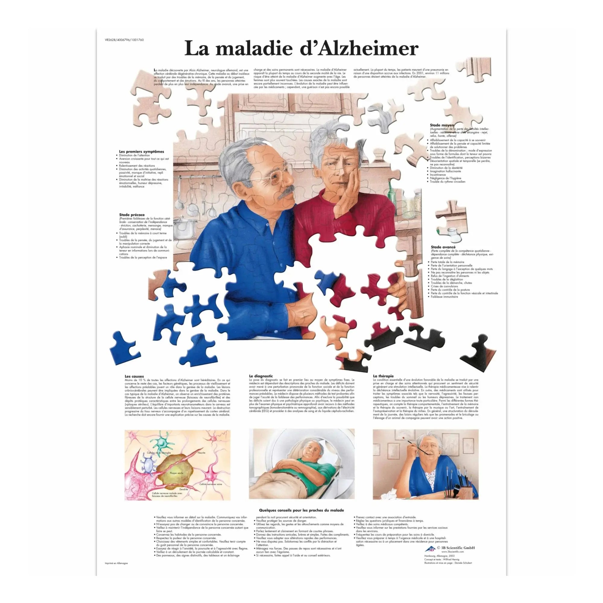Planche anatomique - La maladie d'Alzheimer - Anatomie et pathologie - My Podologie