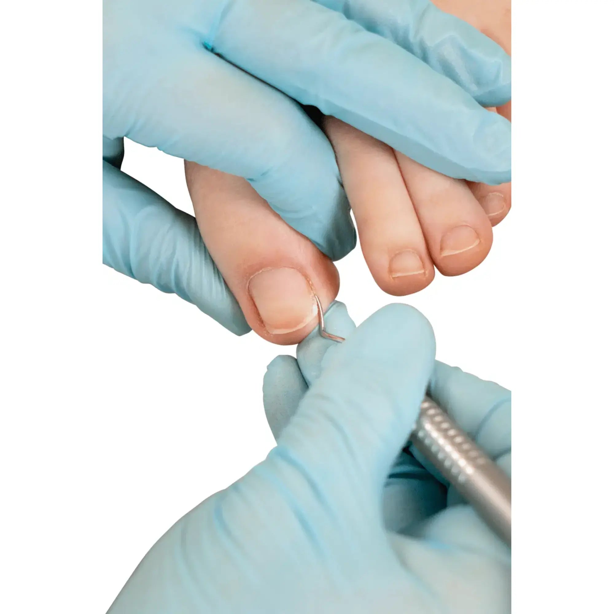 Curette double - Longueur : 17,5 cm - Ruck Ruck