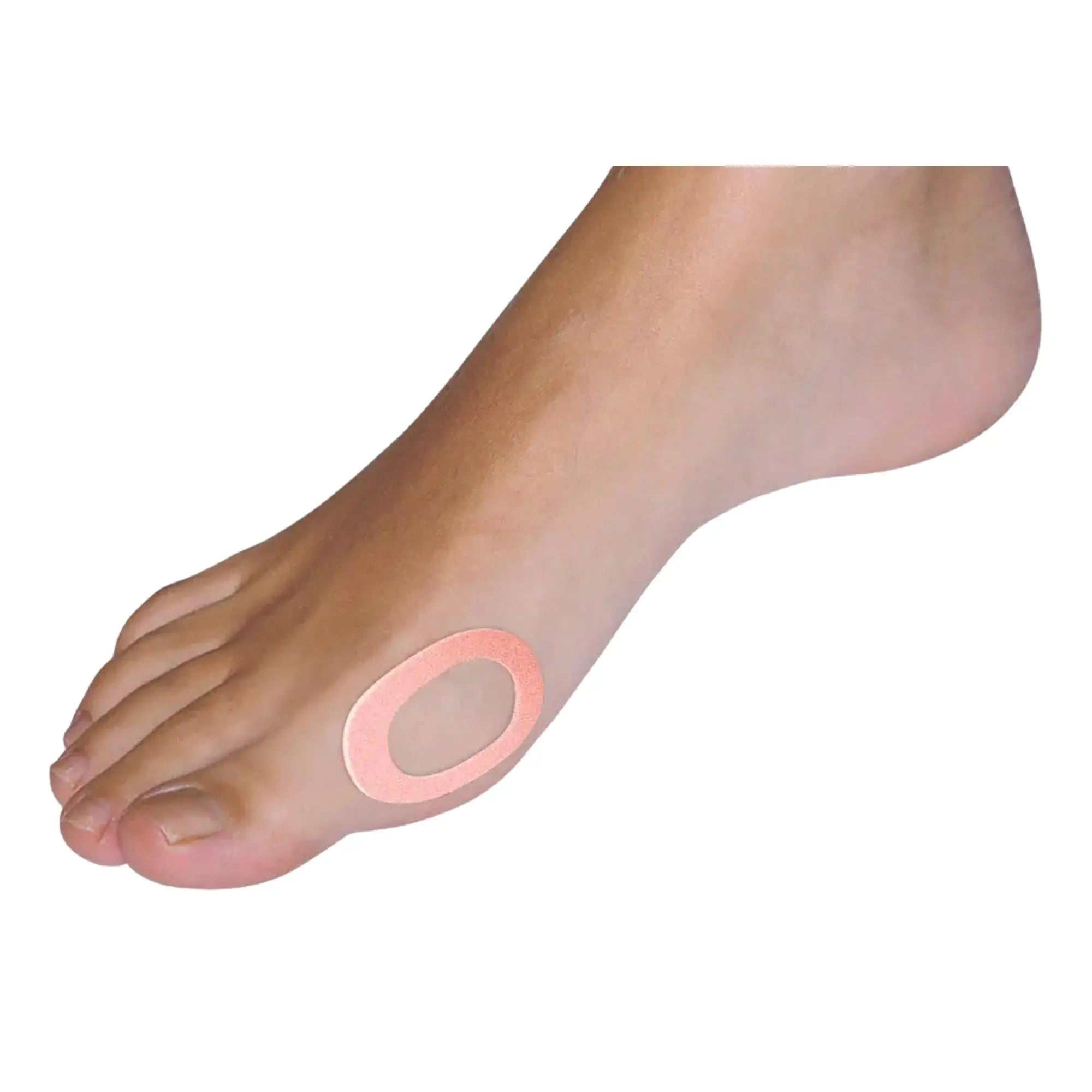 Patchs pour hallux valgus en feutre adhésif  - Paquet de 4 pièces - My Podologie