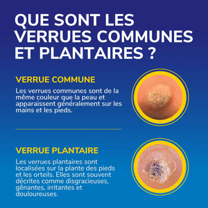 Traitement Verrues - Freeze Away MAX - 35 ml -  Dr Scholl's Scholl 